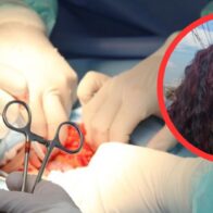 Mujer solicita ayuda para cirugía debido a complicaciones de salud