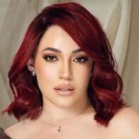 Karen Yapoort presume orgullosa su nueva nariz tras someterse a una cirugía estética