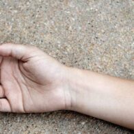 Niña de 10 años muere atropellada por camión recolector de basura en Villa Isabela