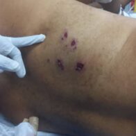 Dominicano fue atacado a tiros en Haití; familia pide ayuda para traerlo a RD y brindarle asistencia médica