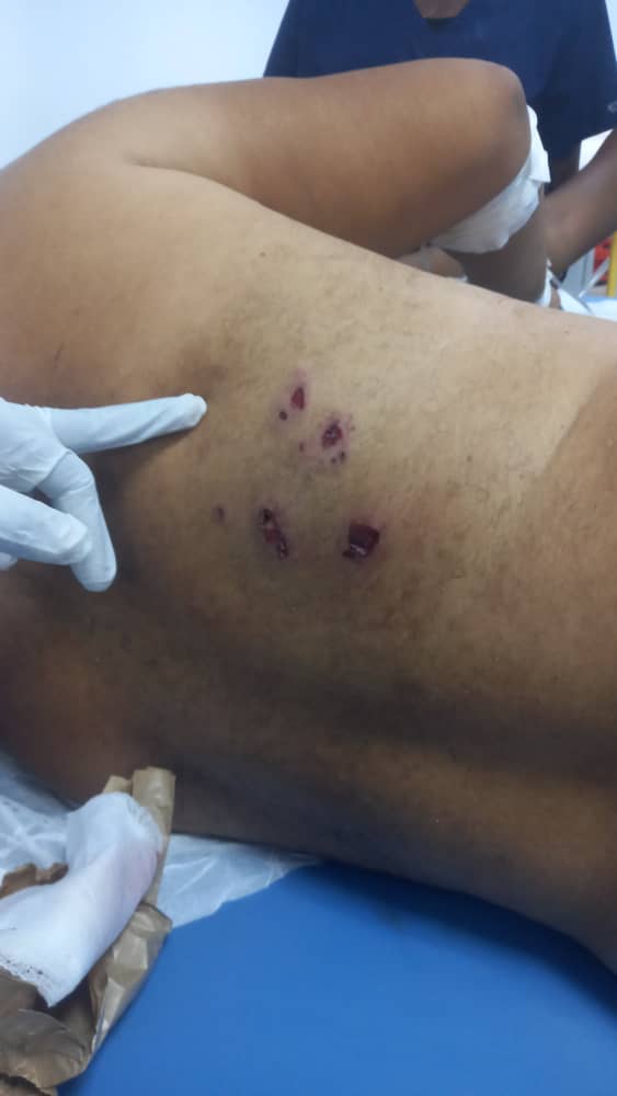 Dominicano fue atacado a tiros en Haití; familia pide ayuda para traerlo a RD y brindarle asistencia médica