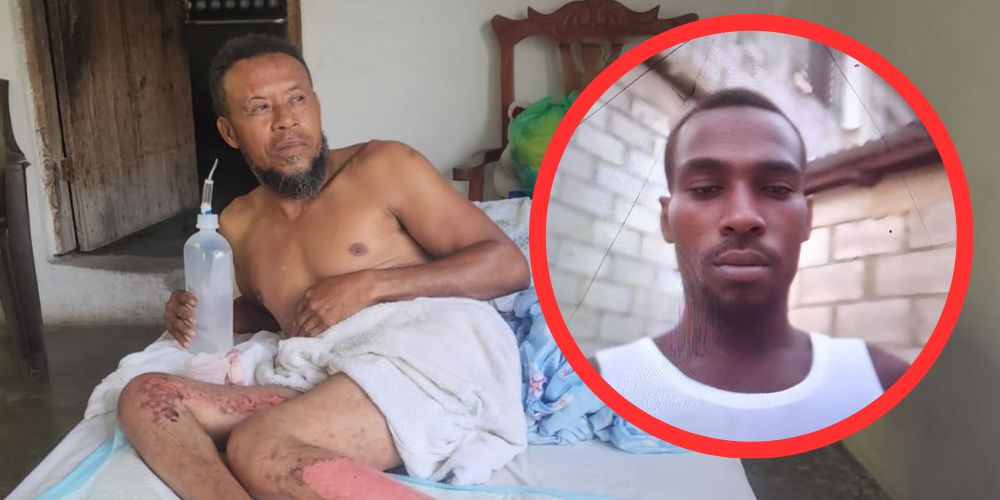 Hombre con limitaciones físicas sobrevive a incendio presuntamente provocado en Neiba