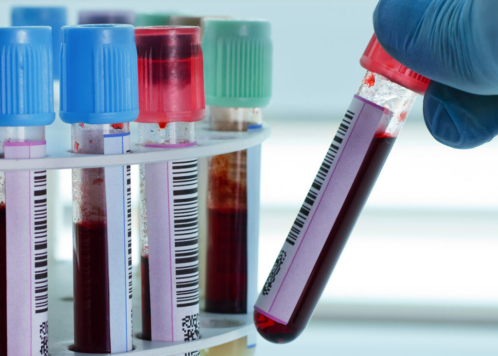 Día Mundial del Cáncer de Sangre: una lucha por la vida y la esperanza