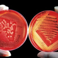 Microbioma
