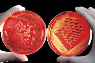 Microbioma