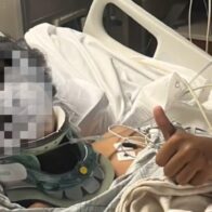 Un rayo impactó a un adolescente durante tormenta en Central Park de Nueva York