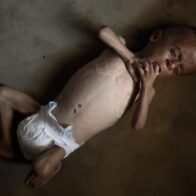 La desnutrición mata a cinco personas, incluido un bebé, en las últimas 24 horas en Gaza