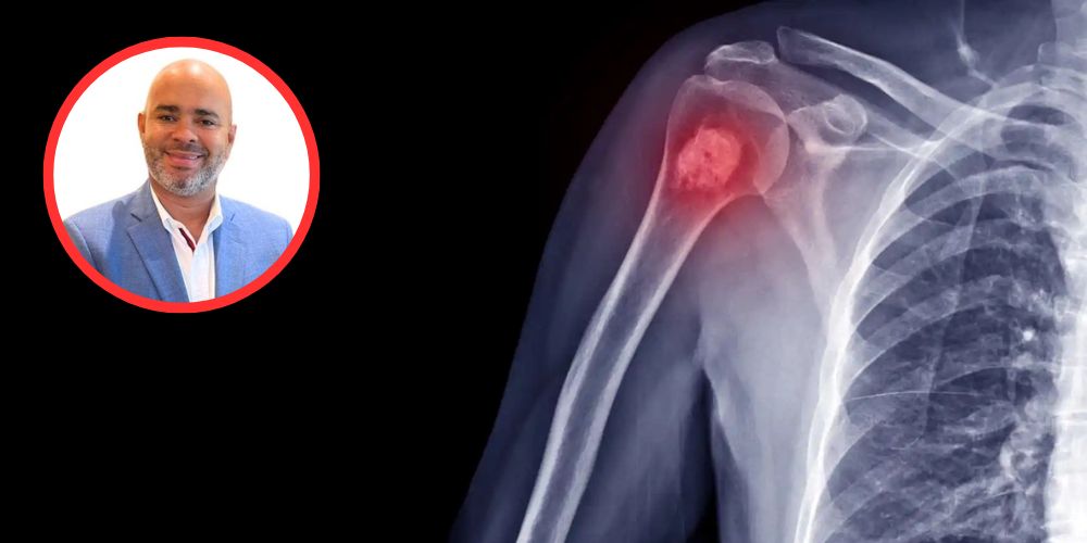 Aumentan tumores a nivel óseo en pacientes luego del Covid-19, afirman especialistas