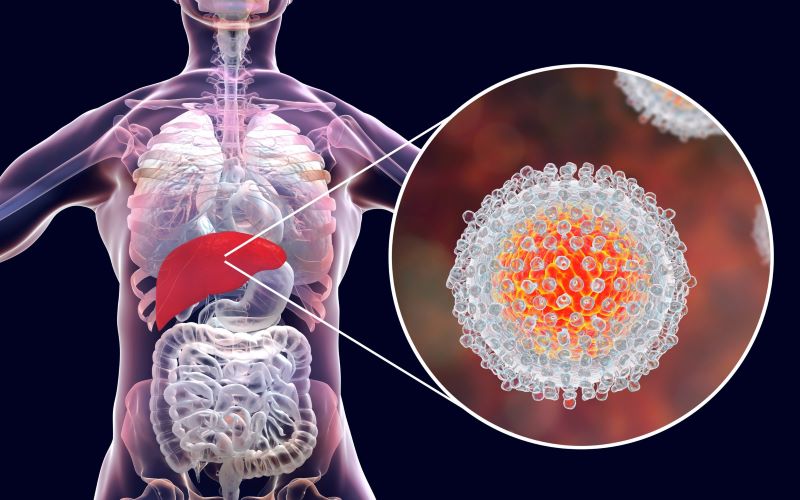 Día Mundial contra la Hepatitis