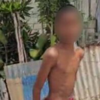 Agreden y amenazan a contratistas de Edeeste que normalizaban servicio en comunidad de Higüey