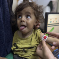 Dos personas murieron ayer por el hambre en Gaza, elevando el total a 271, según Sanidad