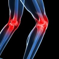 Jornada especial alivia dolor de rodilla con un tratamiento innovador