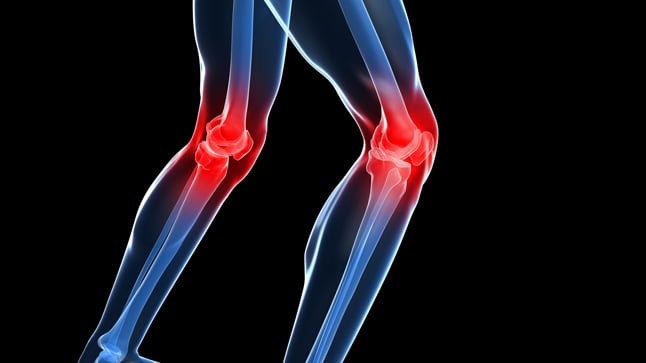 Jornada especial alivia dolor de rodilla con un tratamiento innovador
