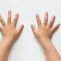 Rescatan en Sosúa a niño haitiano víctima de maltrato; madre y hermana serán sometidas