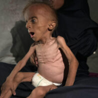 Seis nuevos gazatíes mueren por desnutrición, dos de ellos niños