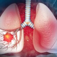 Pulmones saludables: hábitos que ayudan a prevenir enfermedades respiratorias