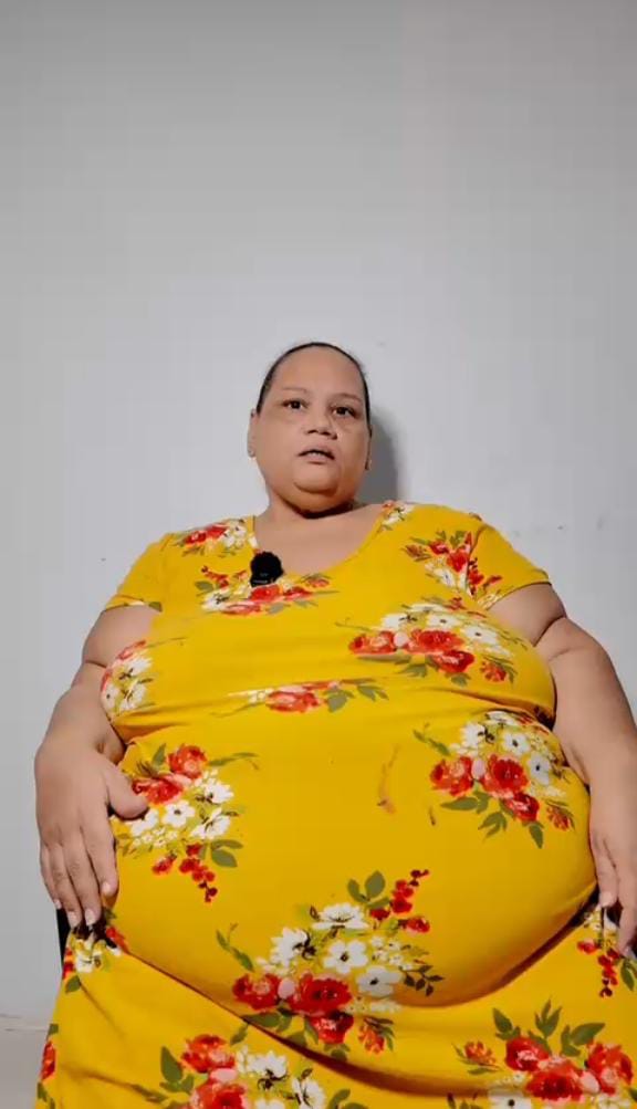 Mujer de 46 años solicita ayuda para cirugía bariátrica tras complicaciones de salud