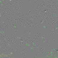 Descubren un mecanismo bacteriano que podría destruir células tumorales