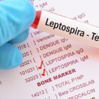 República Dominicana reporta 11 nuevos casos de leptospirosis tras paso de la tormenta Melissa