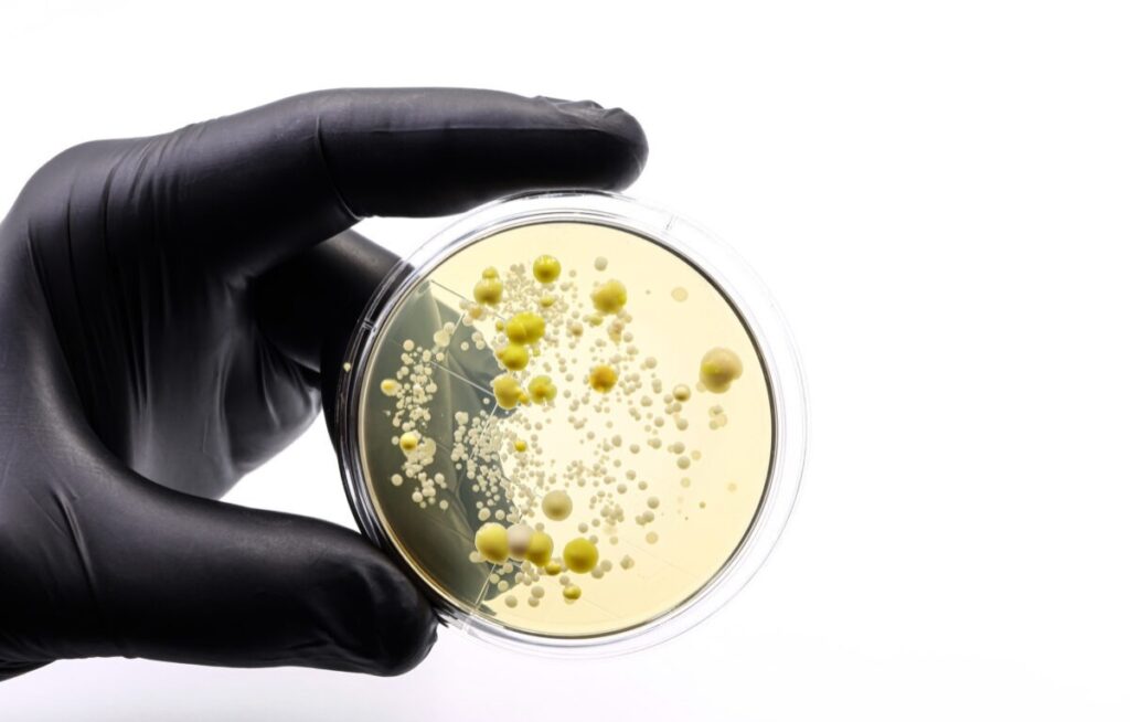 Descubren que un fármaco contra el cáncer es eficaz contra una bacteria multirresistente