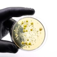 Descubren que un fármaco contra el cáncer es eficaz contra una bacteria multirresistente