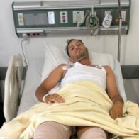 Hombre pierde una pierna en ataque atribuido al exesposo de su pareja en Santiago