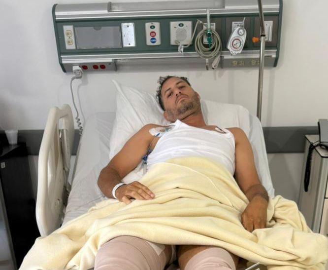 Hombre pierde una pierna en ataque atribuido al exesposo de su pareja en Santiago