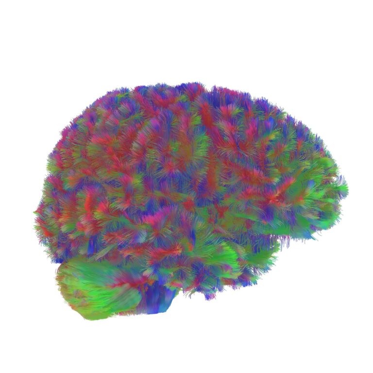 El cerebro pasa por 5 fases en la vida, que cambian a los 9, 32, 66 y 83 años