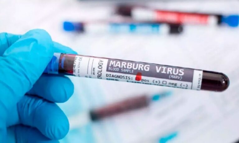 Elevan a siete los muertos por el brote de la enfermedad del virus de Marburgo en Etiopía