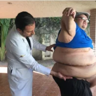 Muere Juan Pedro Franco, quien obtuvo el récord Guinness como el hombre más obeso del mundo