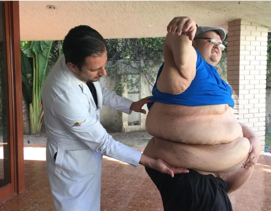 Muere Juan Pedro Franco, quien obtuvo el récord Guinness como el hombre más obeso del mundo