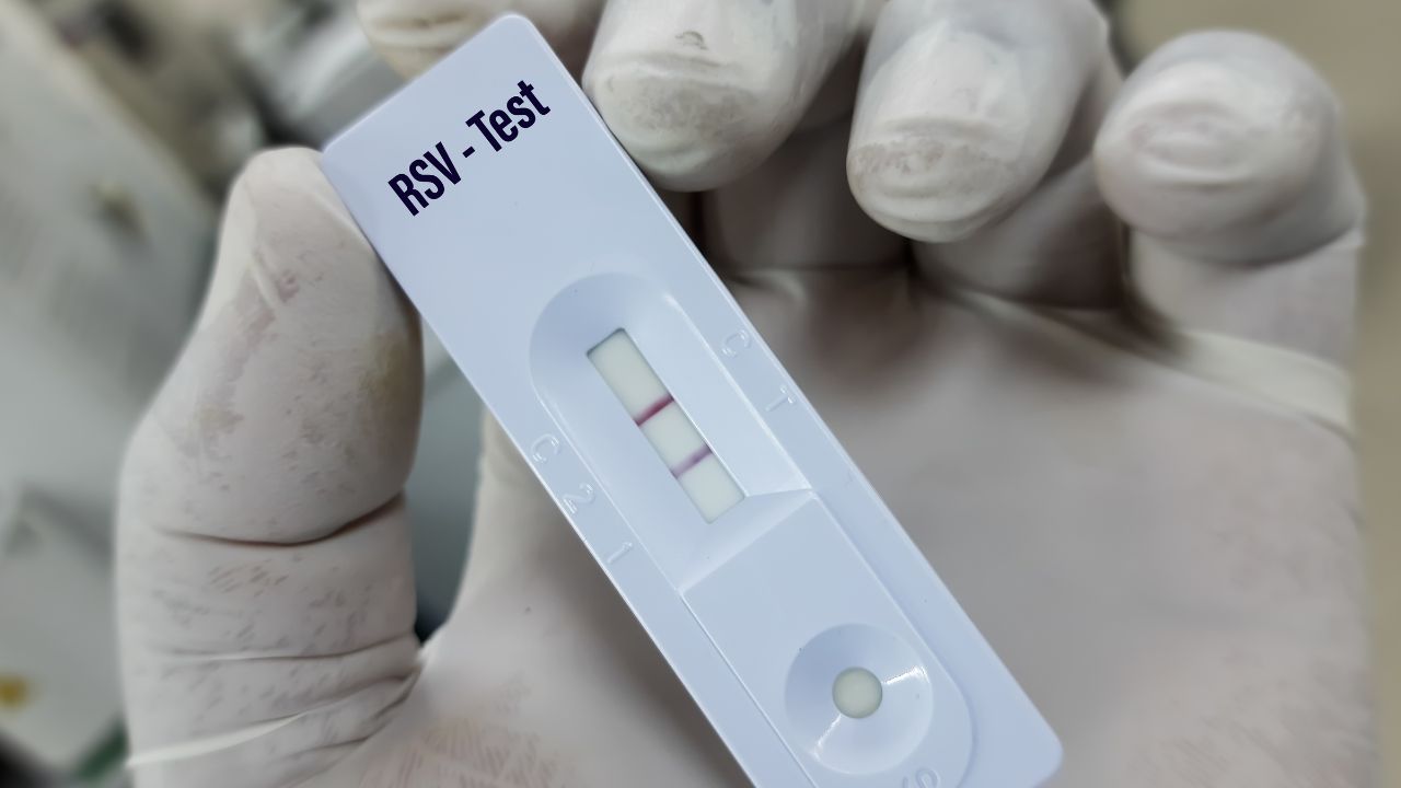 Alto costo de pruebas limita cifras reales de virus respiratorios en Santiago