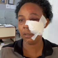 Mujer denuncia brutal agresión por parte de su hijo en SFM