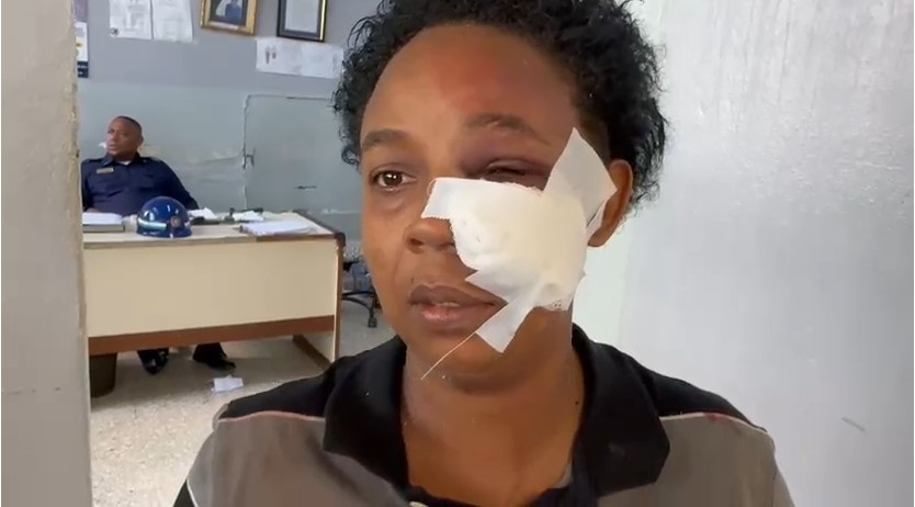 Mujer denuncia brutal agresión por parte de su hijo en SFM