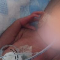 Familiares solicitan apoyo para cubrir gastos médicos de bebé prematuro extremo en Samaná