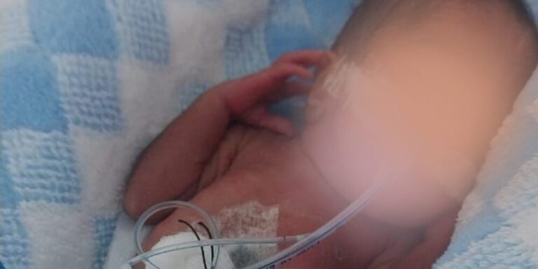 Familiares solicitan apoyo para cubrir gastos médicos de bebé prematuro extremo en Samaná