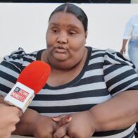 "Yo quiero ver a mis hijos crecer", entre lagrimas joven con elefantiasis solicita ayuda