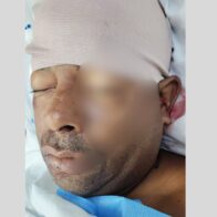 Dos heridos tras enfrentamiento en un juego de dominó en Los Botados de Yamasá