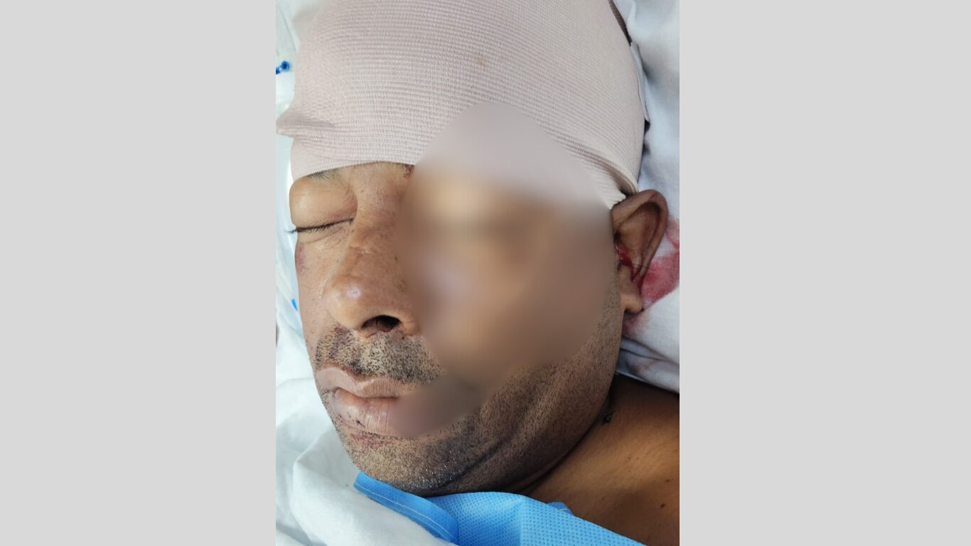 Dos heridos tras enfrentamiento en un juego de dominó en Los Botados de Yamasá