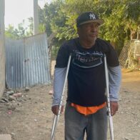 Motoconchista accidentado en Santiago Oeste clama por ayuda para sostener a su familia