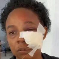 Dictan 3 meses de prisión preventiva contra joven que propinó brutal SFM