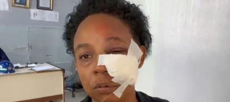 Dictan 3 meses de prisión preventiva contra joven que propinó brutal SFM