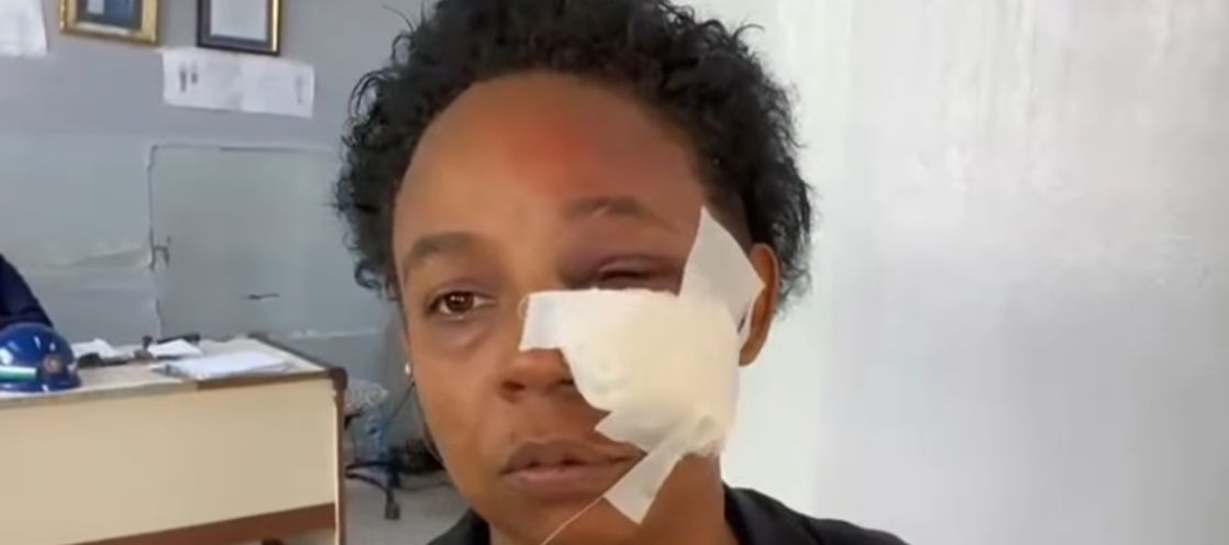 Dictan 3 meses de prisión preventiva contra joven que propinó brutal SFM