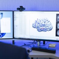 IA y dispositivos portátiles transforman el tratamiento de la epilepsia