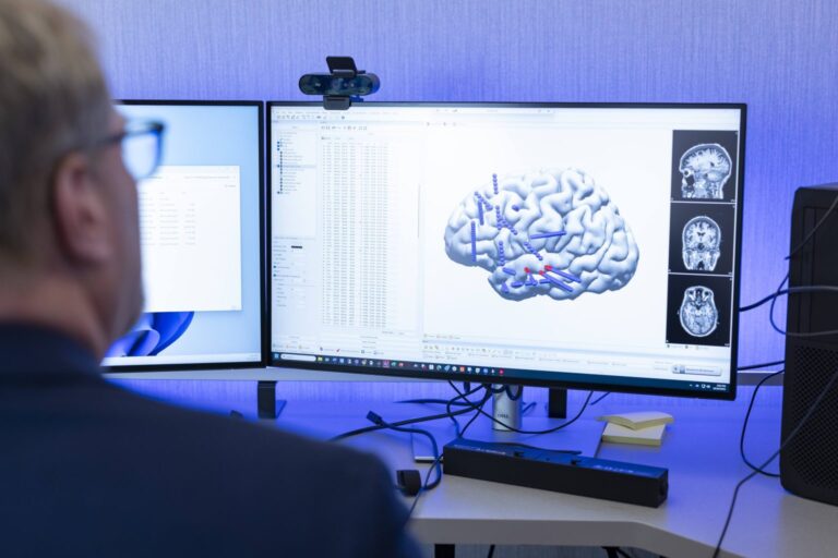IA y dispositivos portátiles transforman el tratamiento de la epilepsia