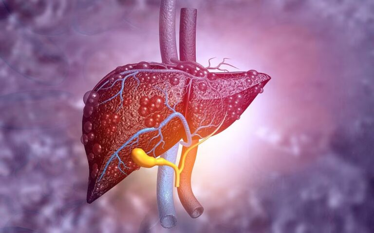 Análisis de sangre revela enfermedad hepática relacionada con el alcohol