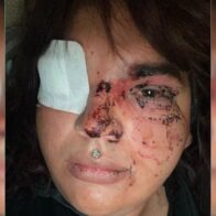 Trans denuncia haber sufrido violenta agresión grupal tras intentar usar el baño de mujeres de un bar de España