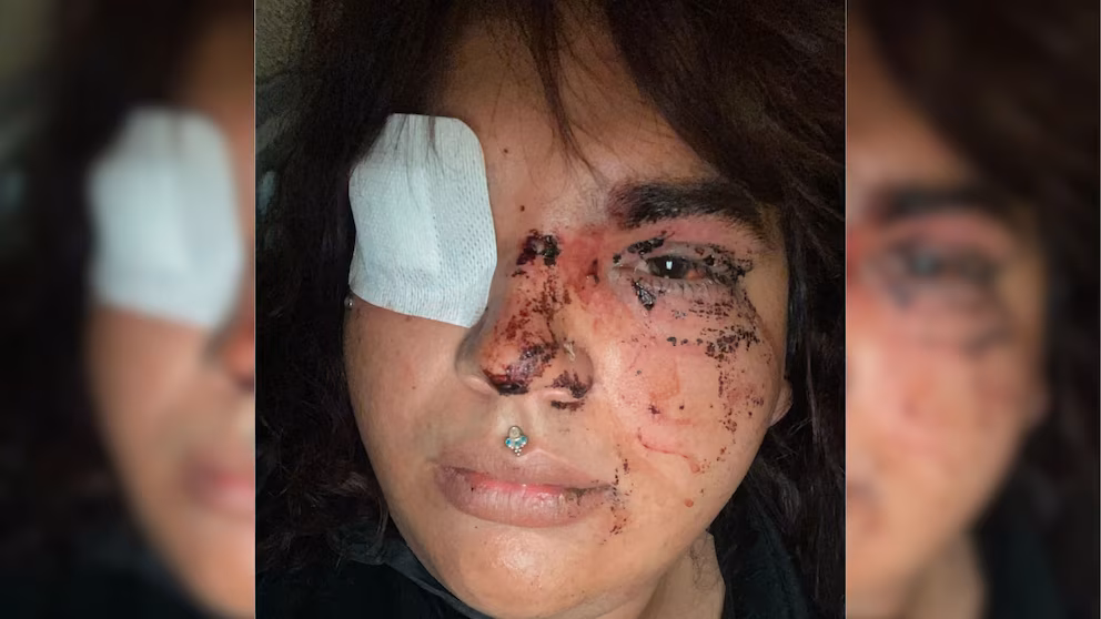 Trans denuncia haber sufrido violenta agresión grupal tras intentar usar el baño de mujeres de un bar de España