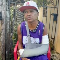 “Me rompió el brazo y siguió como si nada”: Zapatero cuenta el calvario que vive tras ser embestido por motorista calibrando