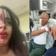 Solicitan prisión preventiva a implicados, donde mujer hirió con bisturí agentes de la Digesett en Aeropuerto del Cibao